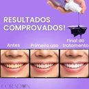 LUMEA Corrector dental de pasta morada
