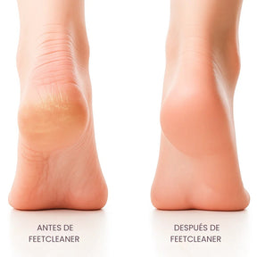 Lima Exfoliador Remueve Callos Pies